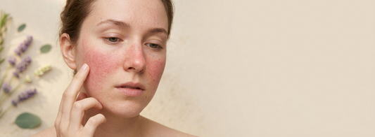 Sensitive Skin Sanctuary: Why Bodyscents Is Perfect for Delicate Complexions
